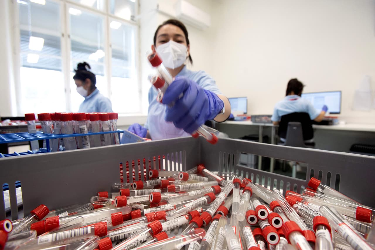 Covid-19 puede provocar cambios en el cerebro incluso si la infección es leve, según nuevo estudio