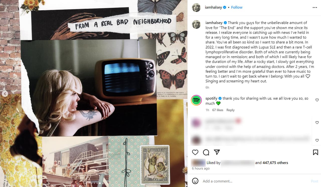 Halsey revela detalles de las enfermedades que padece.