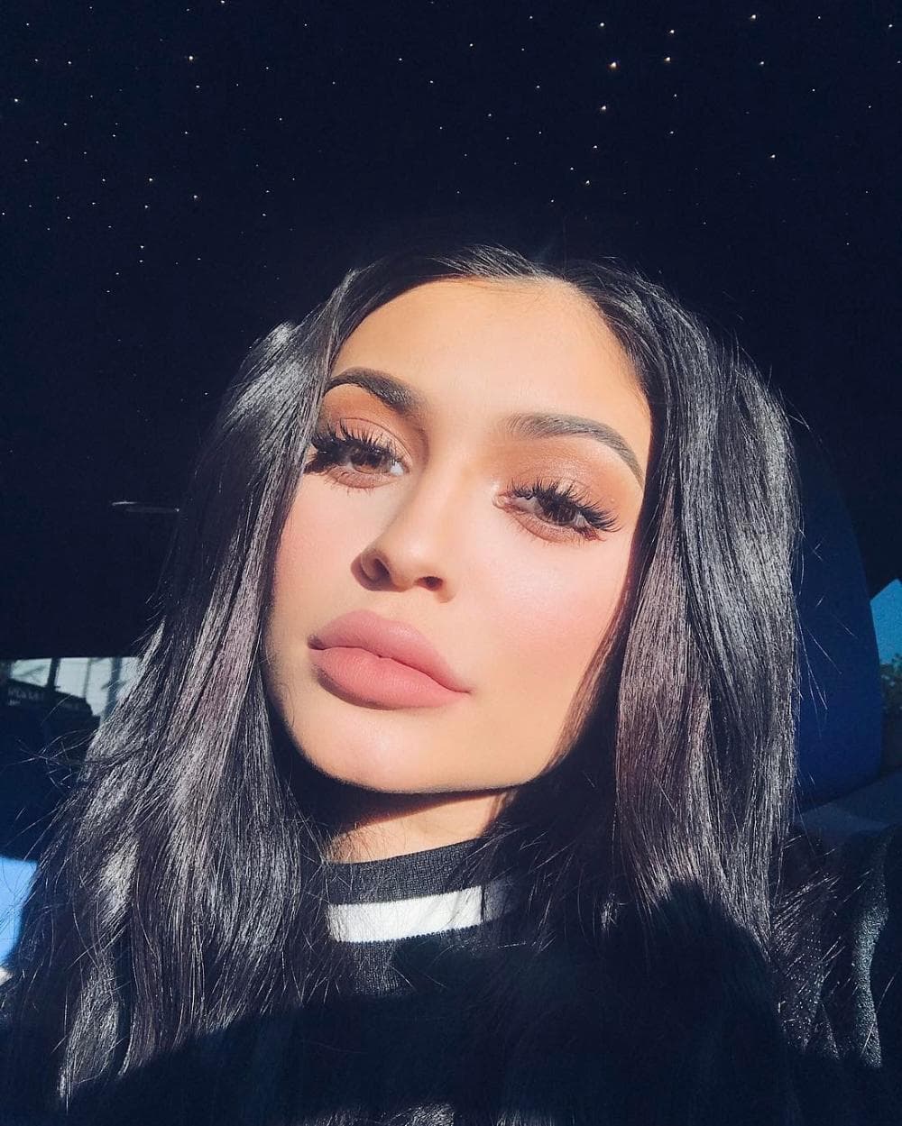 Kylie Jenner se caracterizaba por tener labios grandes y carnosos.
