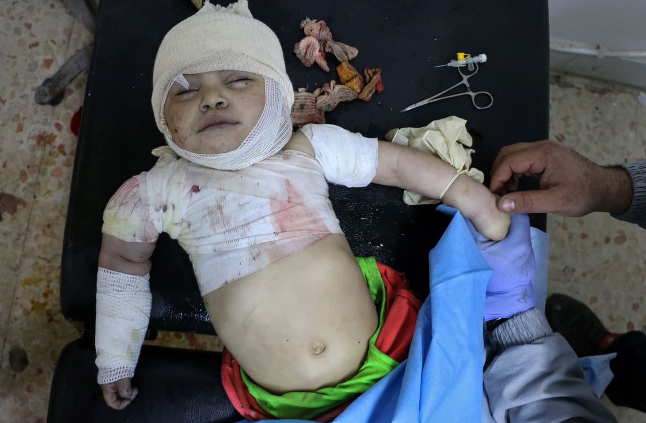 Luego de un bombardeo, un pequeño de cuatro meses de edad recibe tratamiento en un hospital de Damasco. 14 de marzo de 2017.