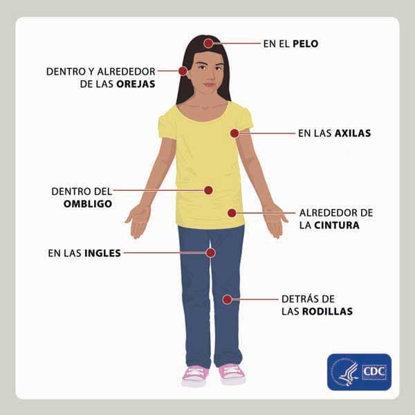 Revise las siguientes partes de su cuerpo y de sus niños para ver si tienen garrapatas.