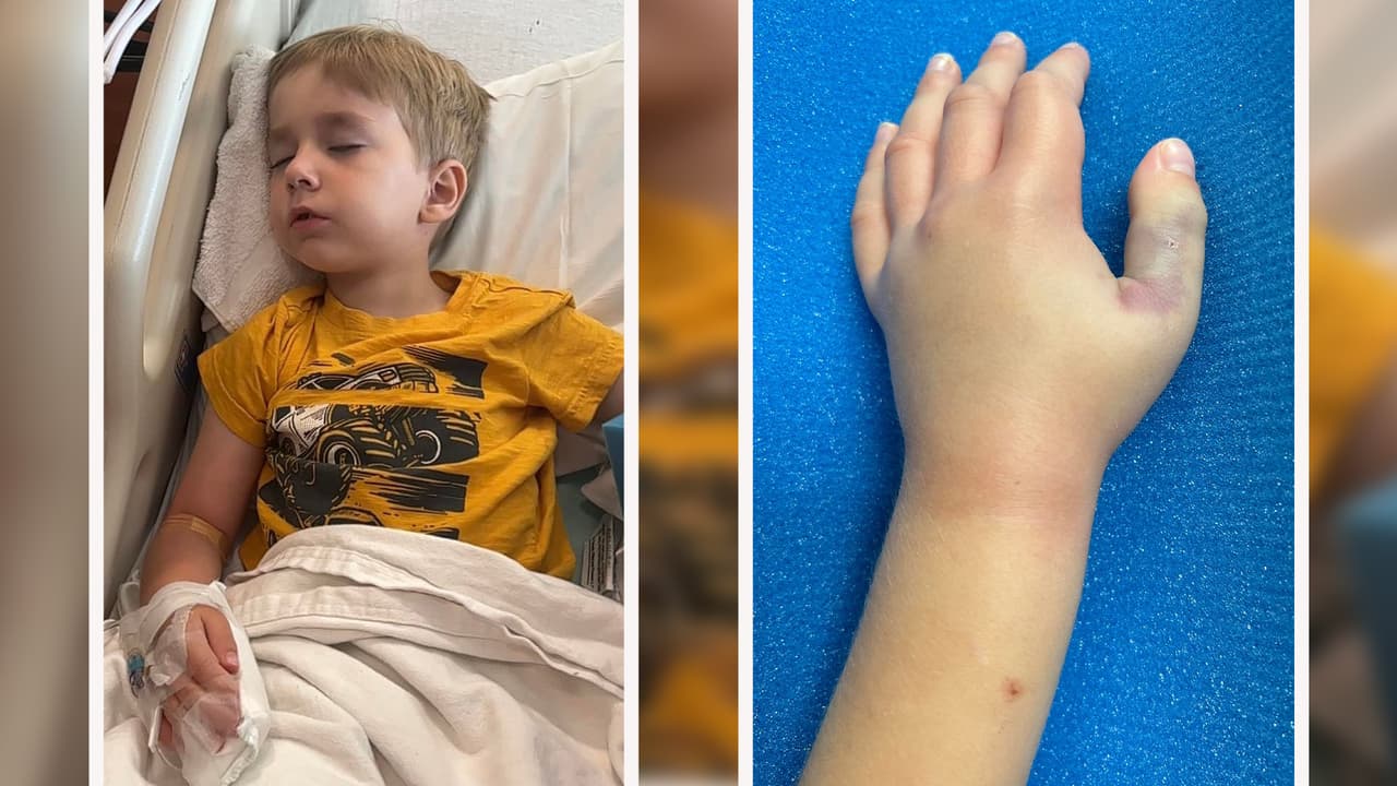 "Lo mordió con su colmillo en el pulgar": Serpiente ‘copperhead’ ataca a un niño de cinco años en Texas 