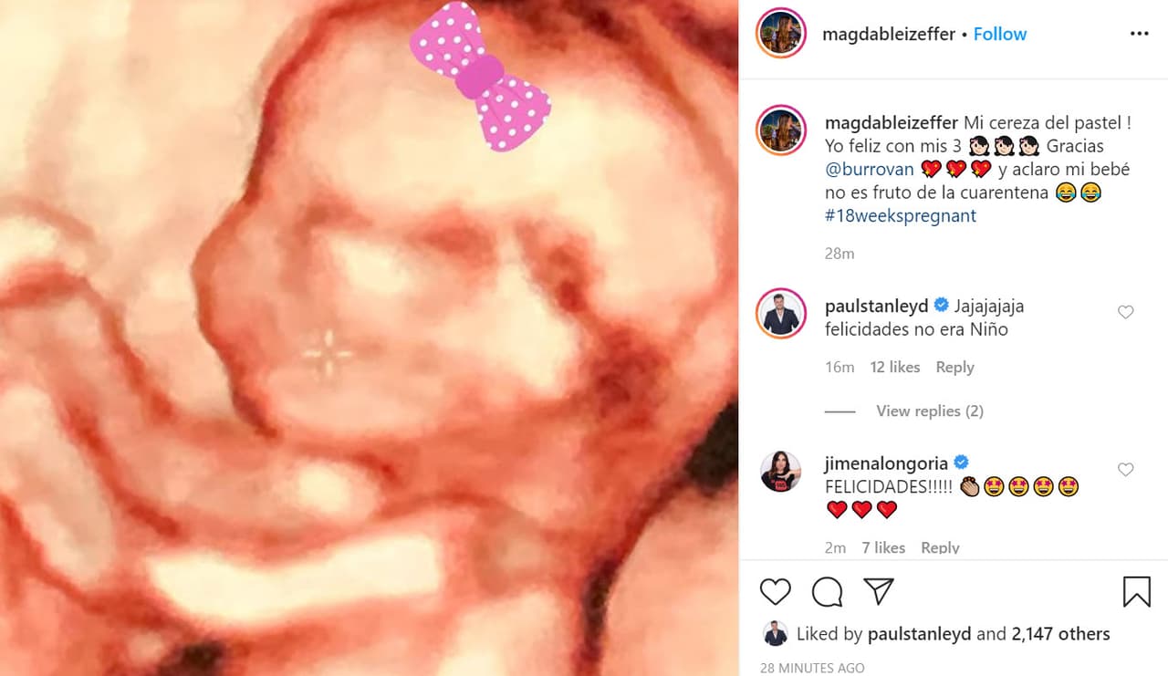 Su pareja compartió en su cuenta de Instagram una foto del ultrasonido del bebé e hizo una relevante aclaración: "Mi bebé 
<b>no es fruto de la cuarentena</b>". Además, en la imagen colocó un moño rosa que podría dar a entender el sexo del nuevo miembro de la familia. De confirmarse que es del sexo femenino, le habrá arruinado la sorpresa a 'El Burro'.
<br>