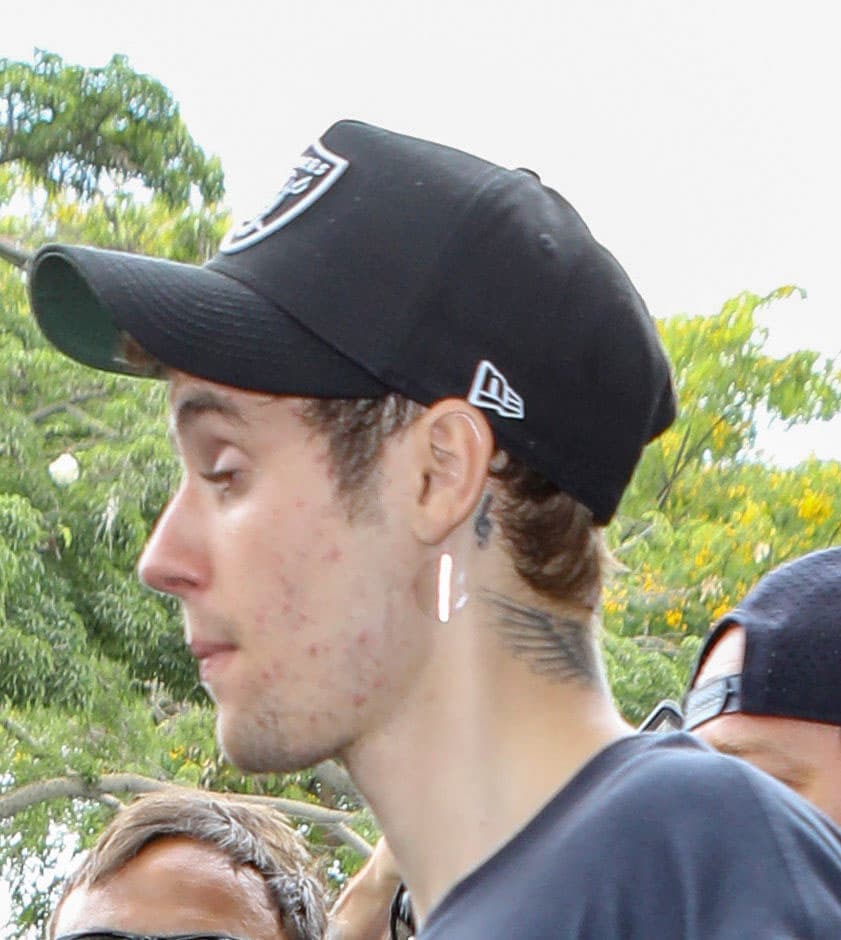 Este tipo de parches medicinales son utilizados para distintos tratamientos, entre ellos la adicción al tabaco o el control del acné.