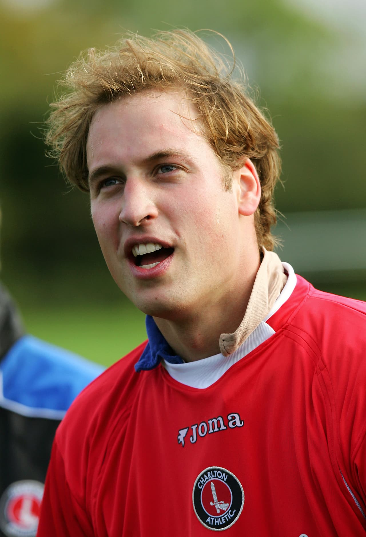 Durante su adolescencia y en los primeros años de su juventud, lució una cabellera acorde a su edad y no había señales de calvicie. 
<br>