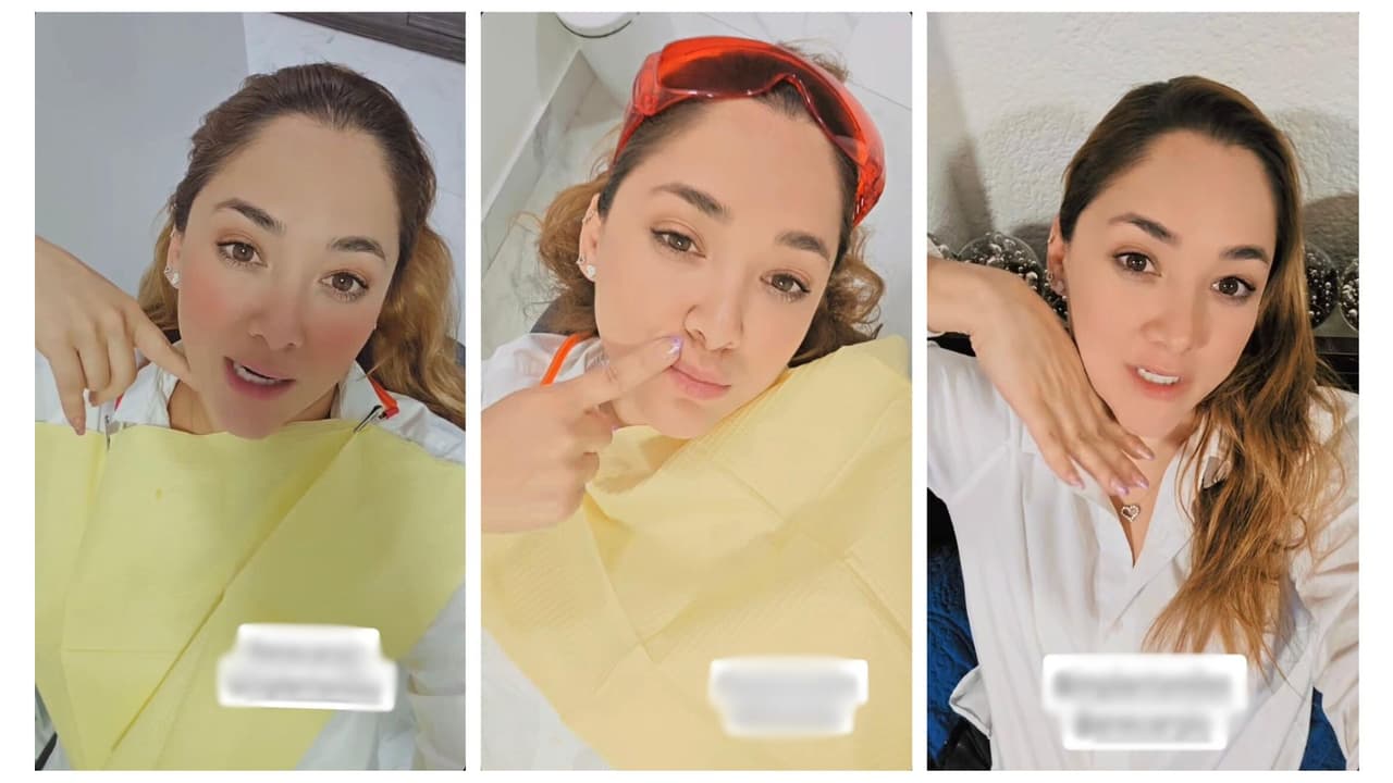 La actriz sufrió una fractura dental el día de su cumpleaños.