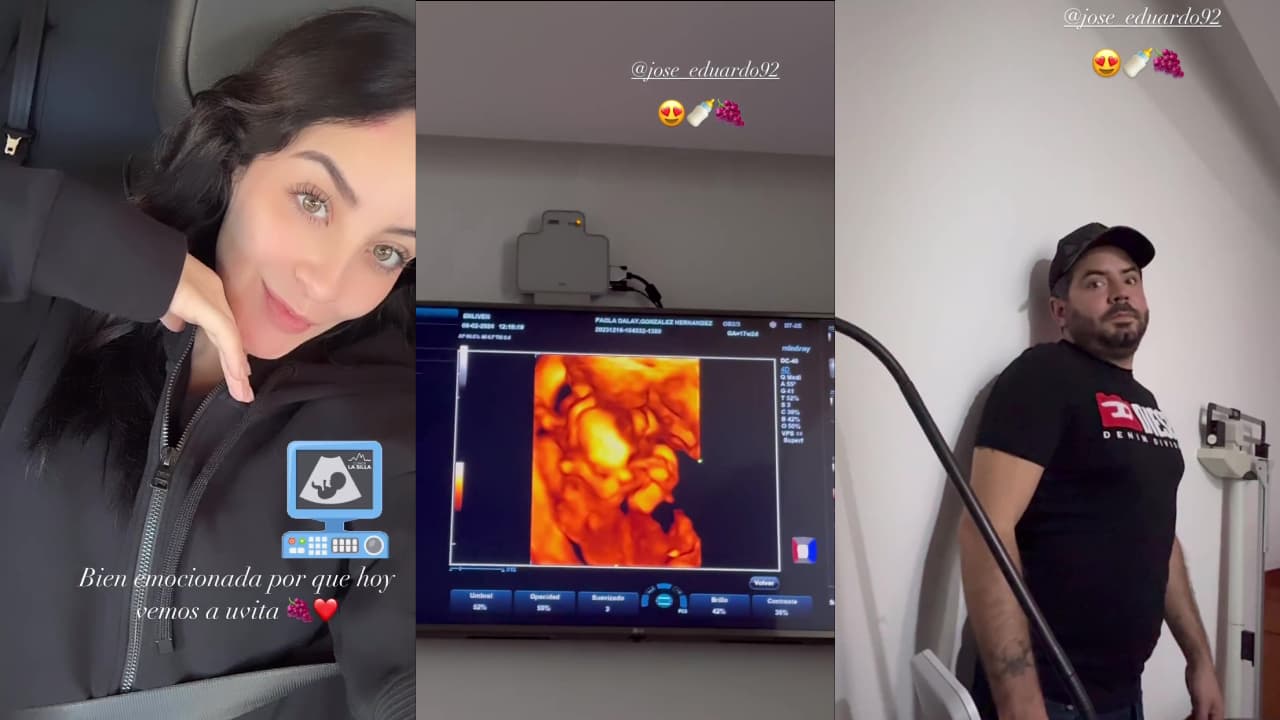 José Eduardo Derbez y su novia dejaron ver el último ultrasonido de su bebé