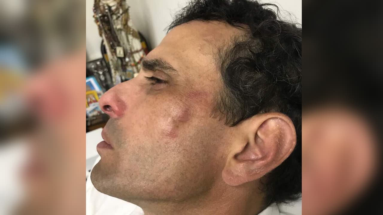 El líder opositor venezolano Henrique Capriles es herido durante una protesta en Venezuela