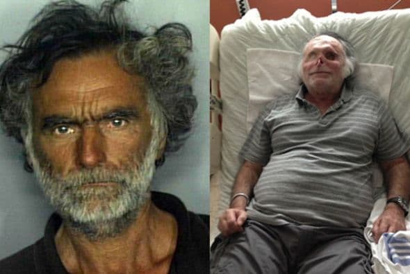 Ronald Poppo, el hombre sin hogar de Florida que ganó notoriedad el año pasado cuando fue atacado por un caníbal mientras dormía, se recupera satisfactoriamente.