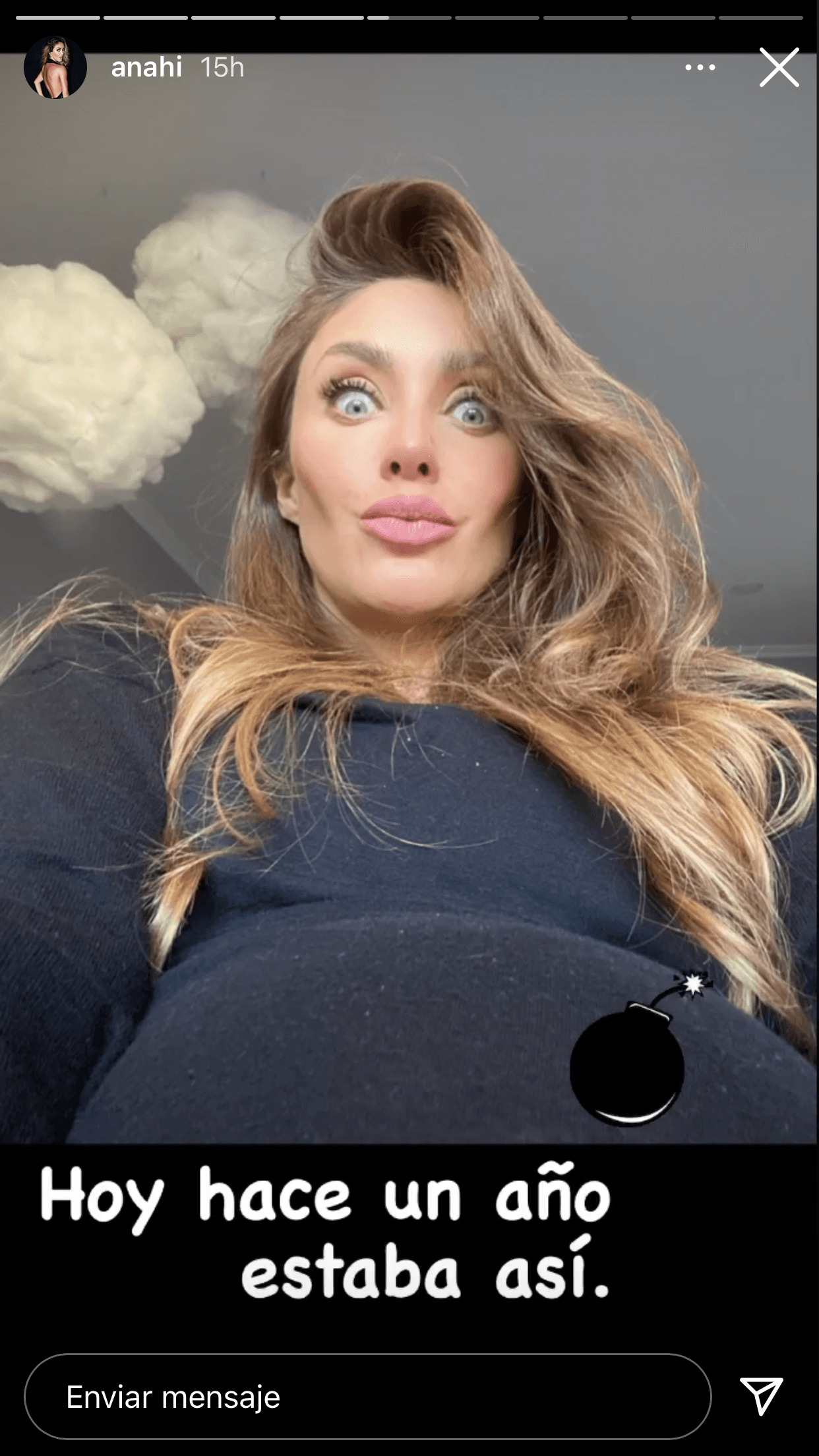 La actriz lo celebró con sus seguidores de Instagram al compartir cómo lucía su cuerpo hace un año a solo horas de dar a luz. 
<br>