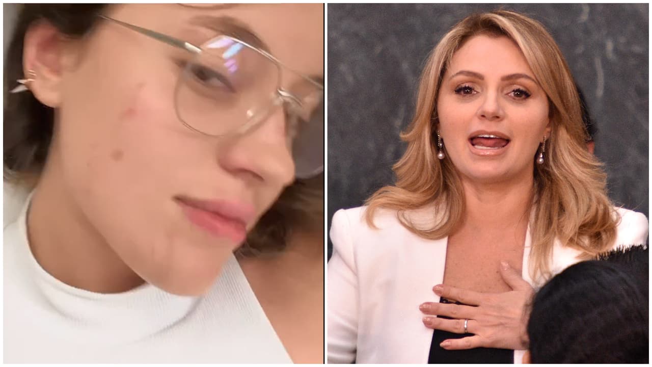 Hija de Angélica Rivera sufre accidente y pierde los dientes: las fotos de cómo quedó