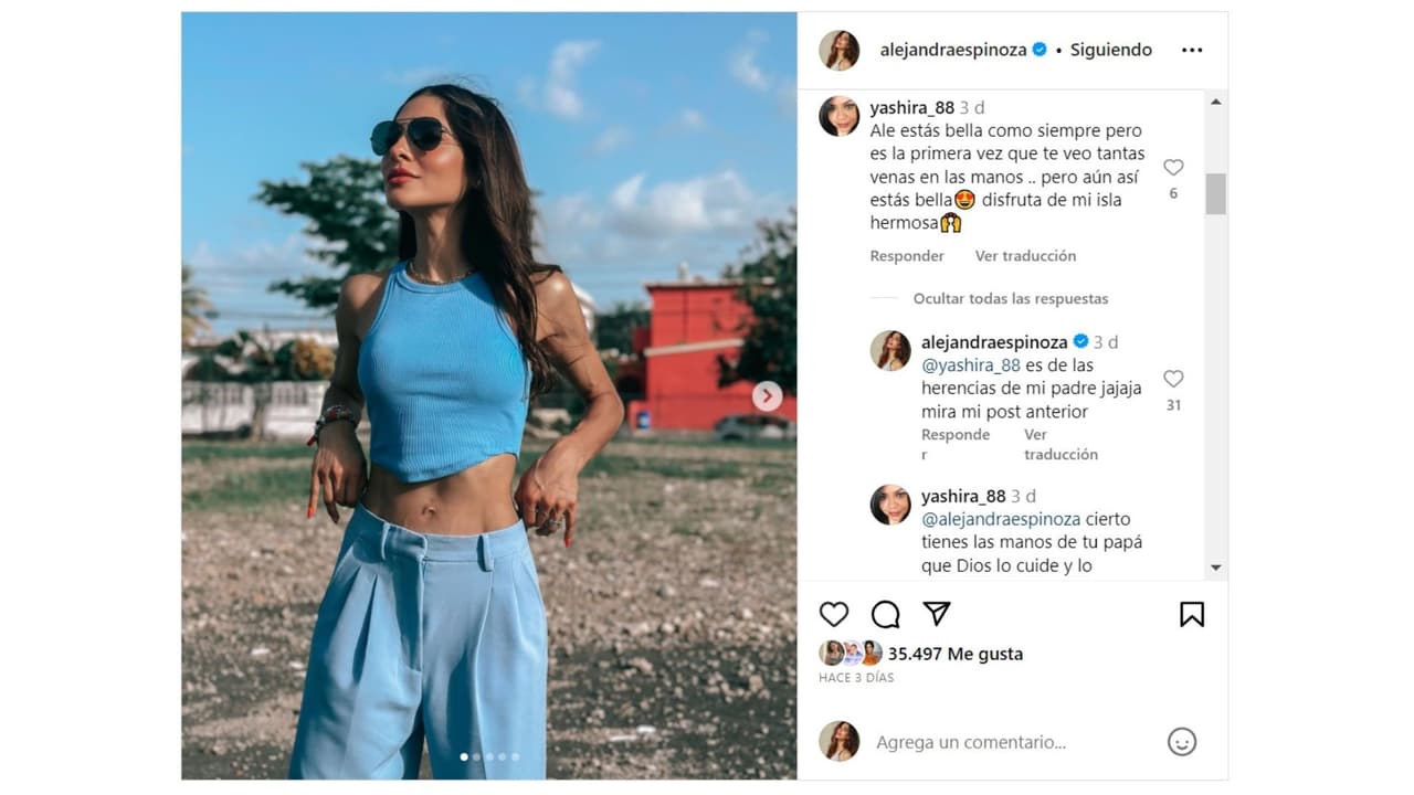 Alejandra Espinoza explicó por qué lucen así sus manos.