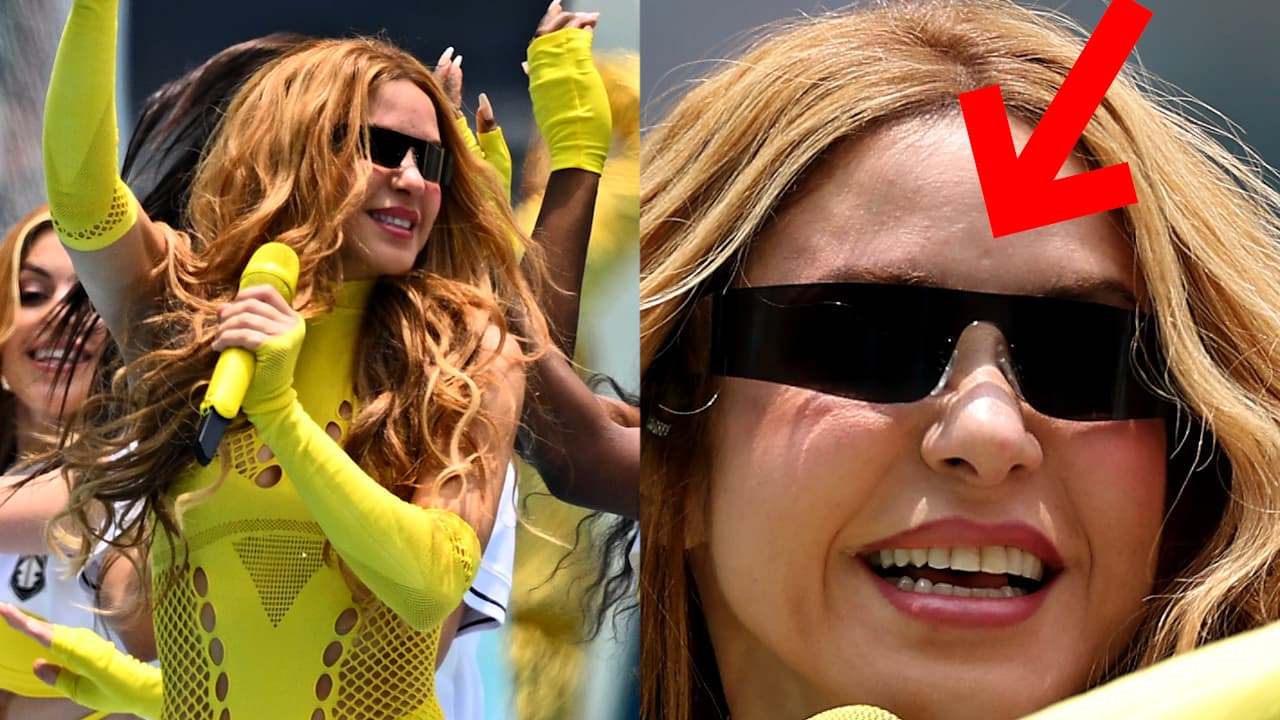 ¿No era Shakira? La cicatriz que terminaría con las teorías de que no se presentó en el Mundial de Futbol