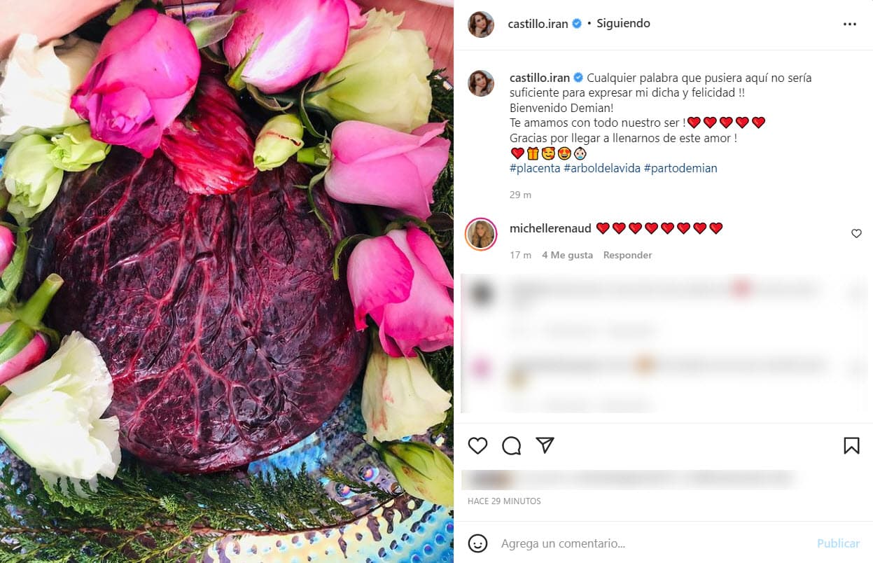 Irán Castillo anuncia el nacimiento de su hijo Demian con una fotografía de una placenta.