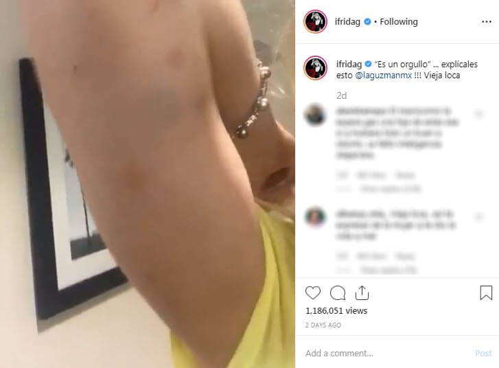 Frida Sofía no tardó en contestar, ese mismo día compartió un video donde mostraba algunos moretones en el brazo con el mensaje: "'Es un orgullo'... ¡explícales esto @laguzmanmx! Vieja loca".