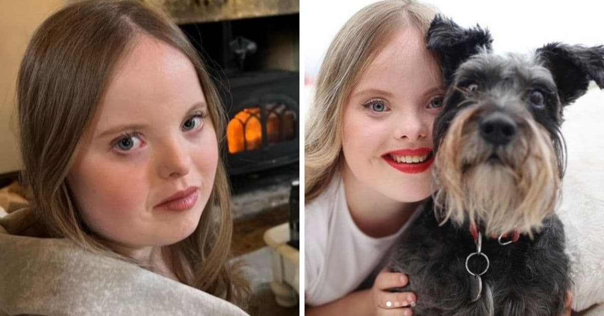 Una joven con síndrome de Down firmó con una importante agencia de modelos: Beth Matthews 