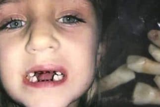 Dentista de Florida le sacó 7 dientes a Bri'el sin necesidad.