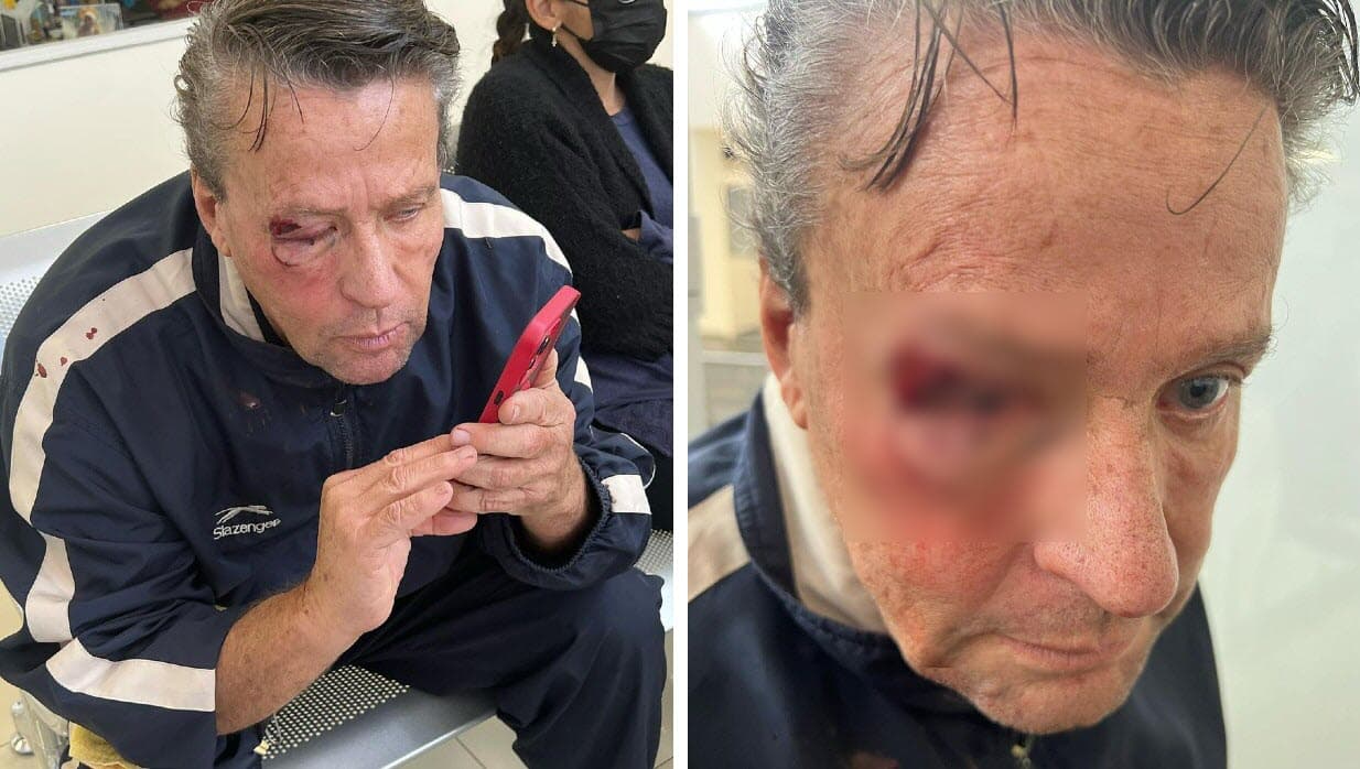 Tras el incidente policíaco en el que se vio involucrado, dio a conocer a los medios de comunicación que tuvo graves lesiones, principalmente en uno de sus ojos.