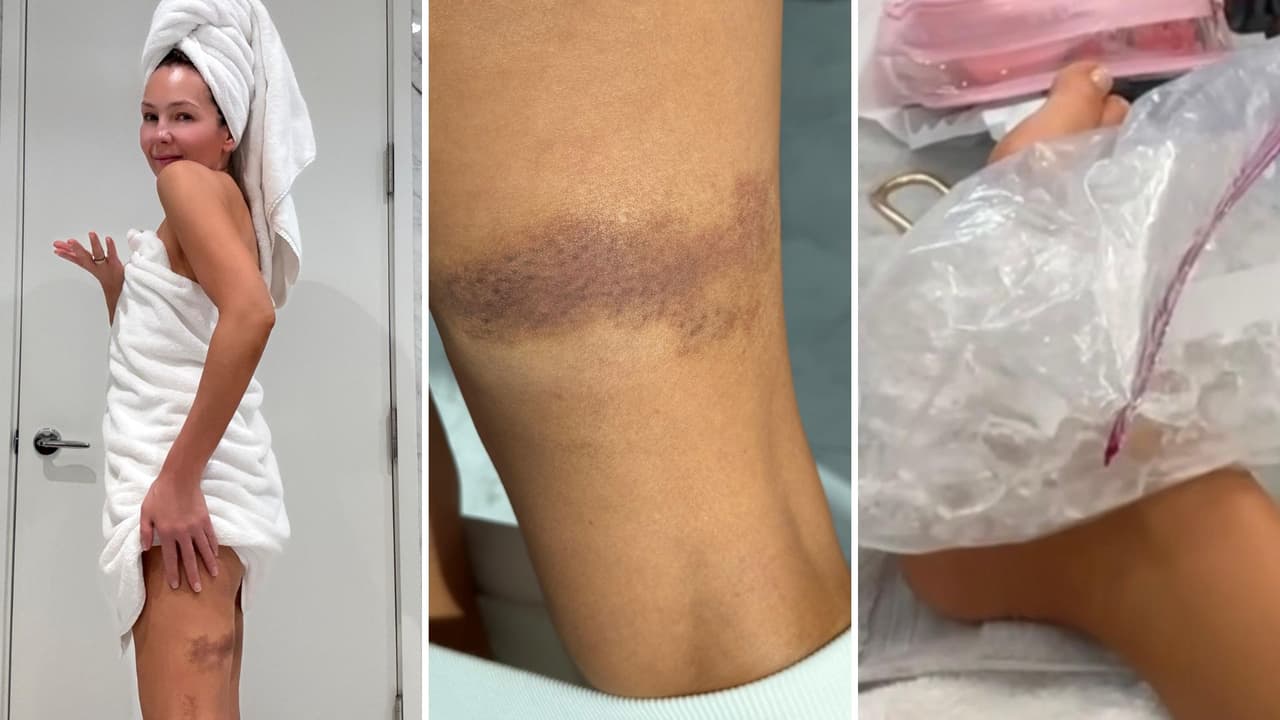 Así documentó Thalía su percance en el escenario.