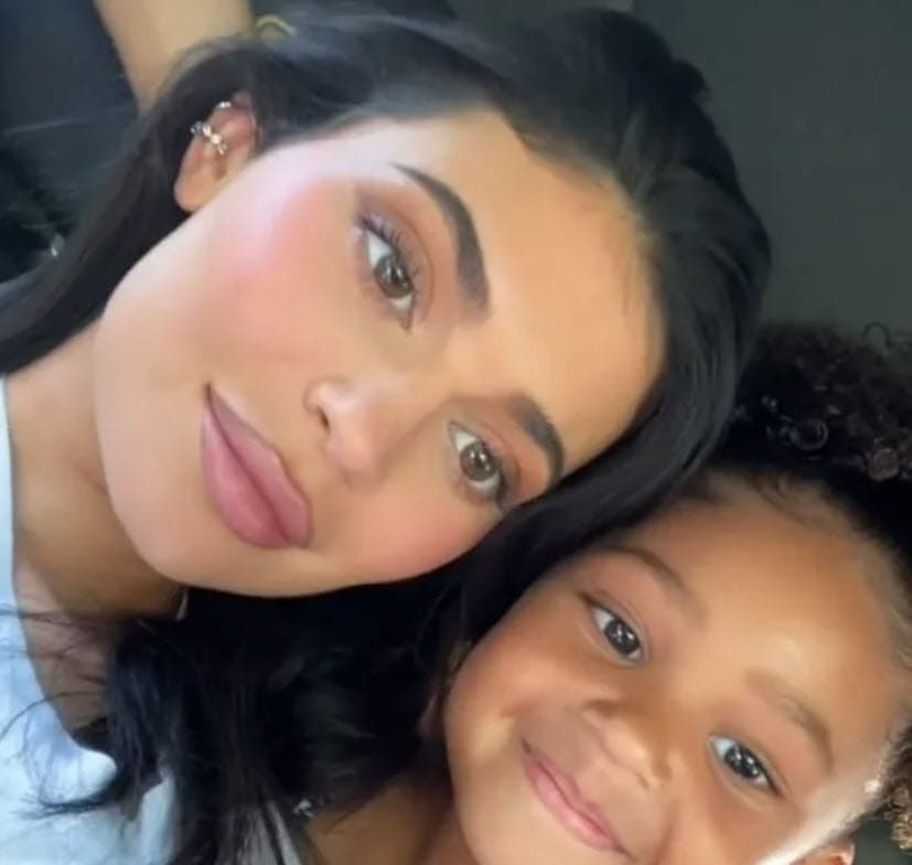 En una entrevista con la revista Complex, Jenner reconoció que su boca había 
<b>"sido una inseguridad"</b> durante "toda su vida".
<br>