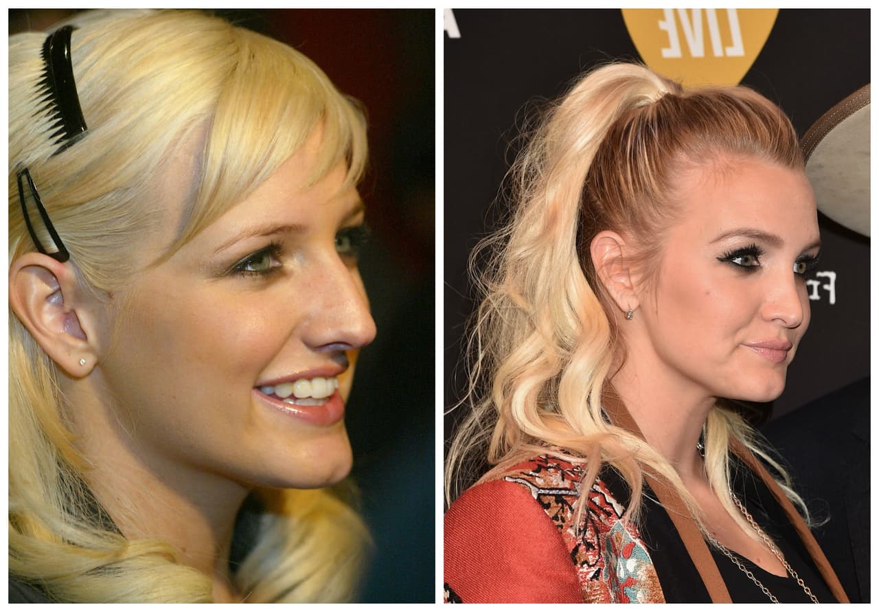 Siendo de la misma familia, la linda Ashlee Simpson también se sometió al mismo procedimiento que su hermana,