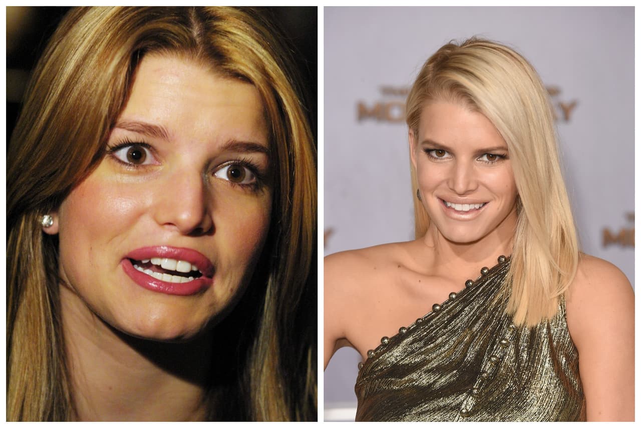 OMG! ¡Qué transformación!.. A una de las que más se les notó el cambio fue a Jessica Simpson, esta rubia sí tenía la denominada nariz aguileña y le tuvieron que raspar el hueso. ¡Ouch!