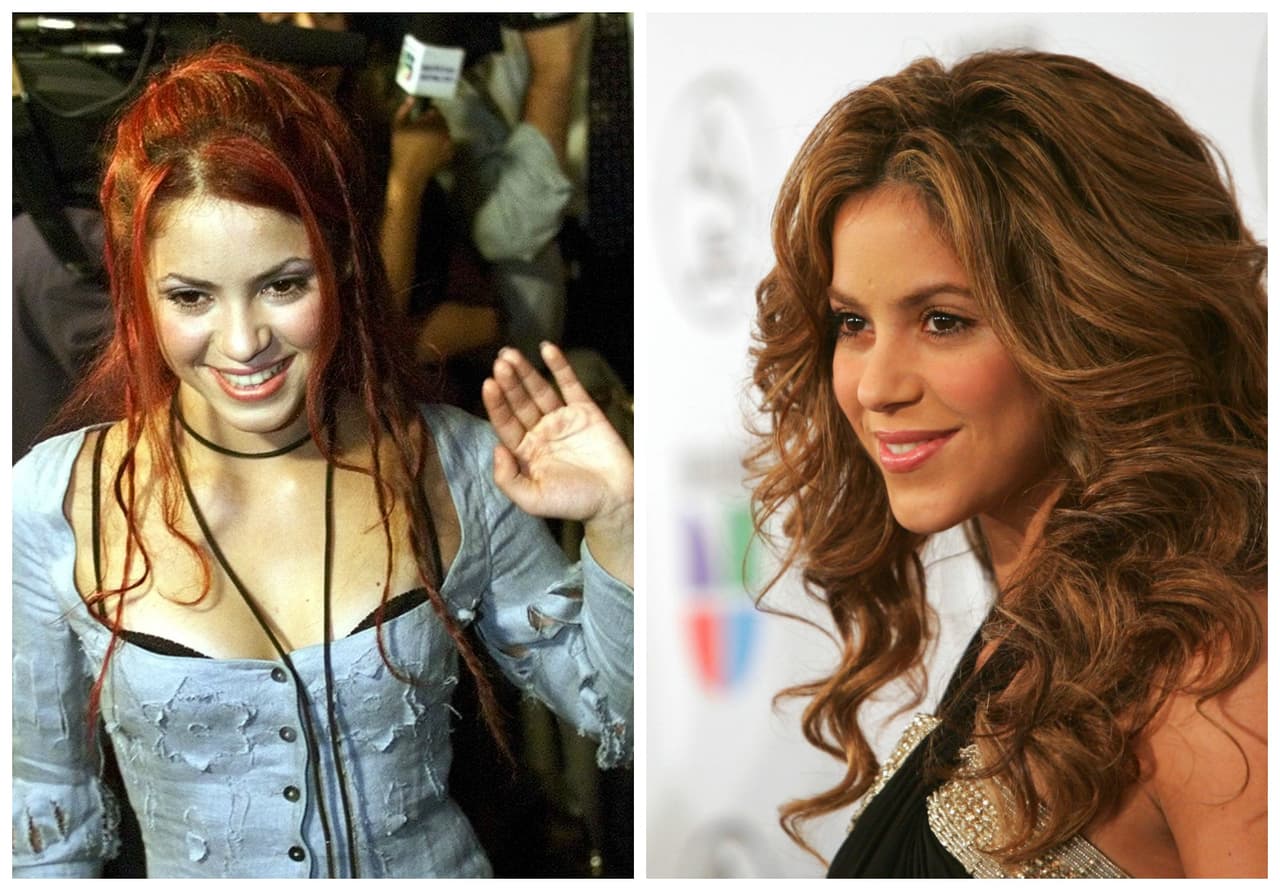 Las caderas de Shakira no mienten, y su nariz tampoco, pues parece que también se hizo un arreglito.