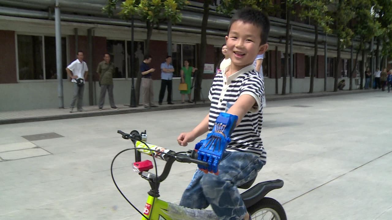 Sólo es cuestión de terapia y constante uso para acostumbrarse.