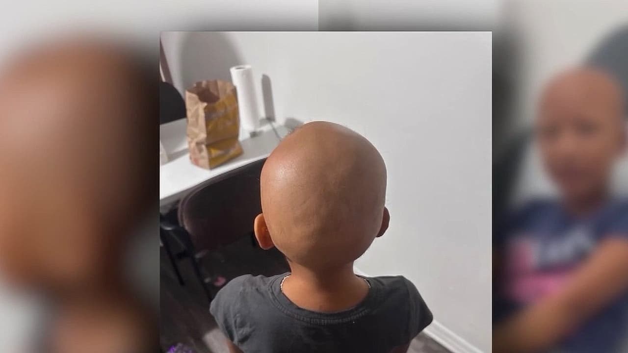 Niña pierde cabello por estrés ante deportaciones y acoso escolar; análisis sobre salud mental