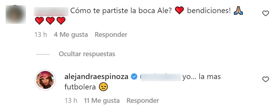 En respuestas que dio a otros usuarios insistió en que fue su habilidad "futbolera" la que la llevó a casi destrozarse la boca.
<br>