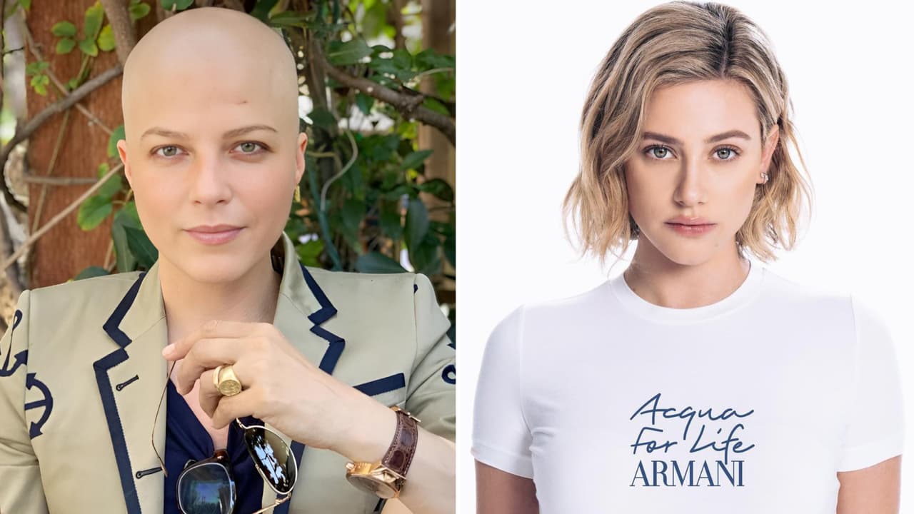 Lili Reinhart y más famosas que se atrevieron a hablar de su alopecia: "Me daba pena"