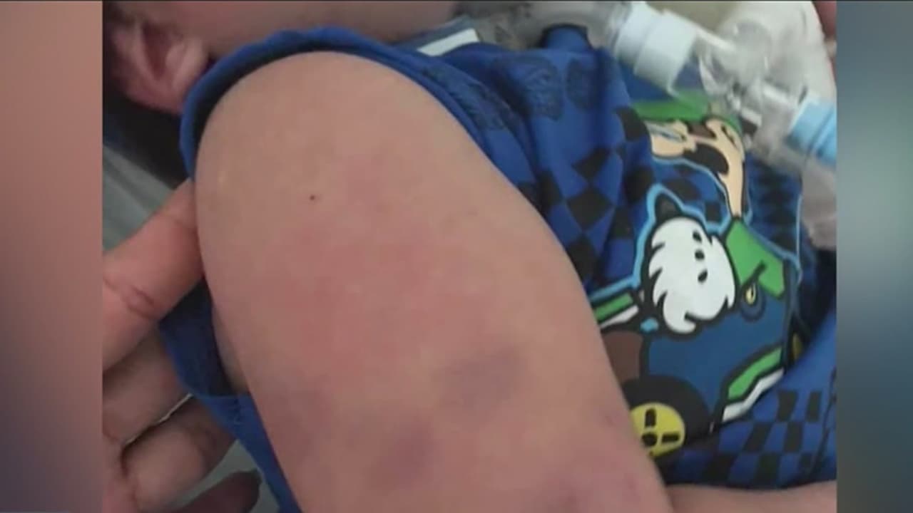 “¿Por qué le hace eso a mi niño?”: Madre asegura que su hijo discapacitado fue maltratado por enfermera en Houston