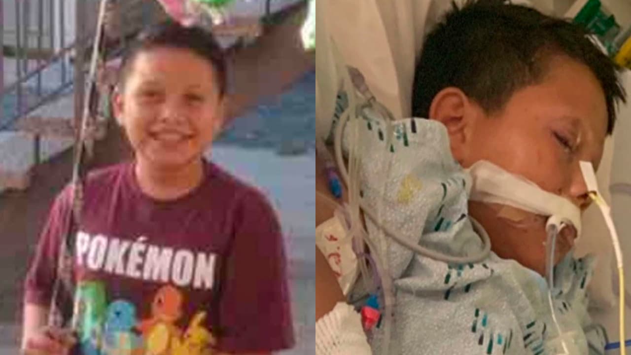 Niño de 10 años pierde su mano izquierda por una bomba que le lanzaron durante su cumpleaños