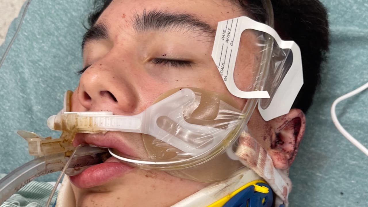 La demanda se basa en lo que sucedió la noche en que la estrella del fútbol, Cole Hagan, casi fue asesinado a golpes, al parecer por sus compañeros de equipo. 
<b>La familia cree que el motivo de la agresión fueron </b>
<a href="https://www.univision.com/local/houston-kxln/reid-mitchell-ayden-holland-logan-huber-cole-hagan-arrestos-sospechosos-houston-texas-fotos">celos por una chica. </a>