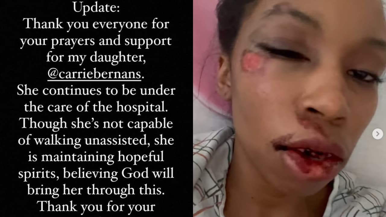 La mamá de Carrie Bernans confirmó que su hija no puede caminar aún sin ayuda a consecuencia de las lesiones que tiene en la pelvis.