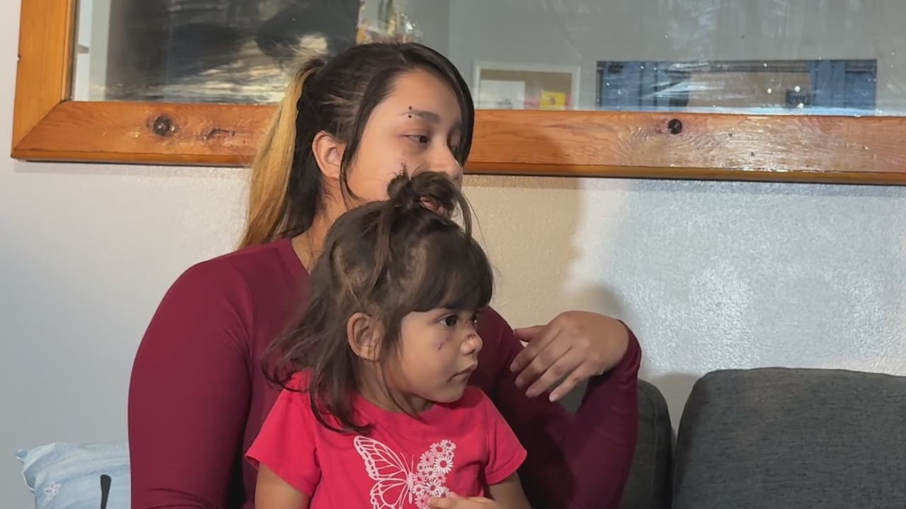 Hombre ataca y muerde en el rostro a una niña de 3 años en San Antonio