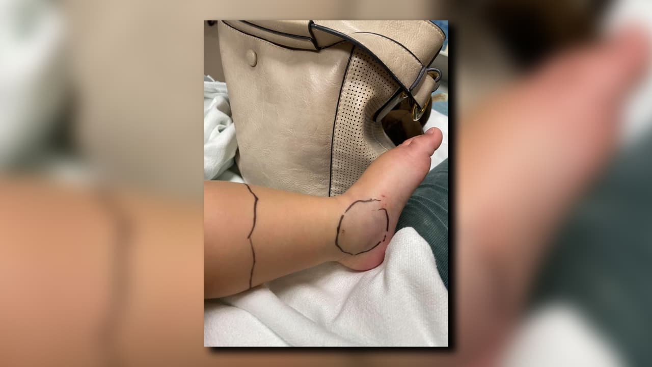 “(La serpiente) se escondía justo al lado de nuestra puerta trasera con sus juguetes”, dijo la familia en una publicación en Facebook.