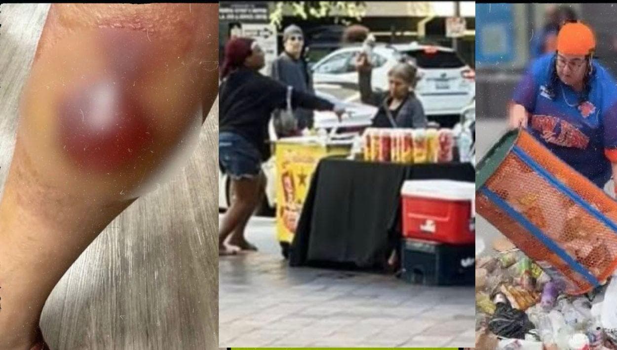 La semana en noticias: Dos cirugías por una picadura, el tajín como escudo protector y maldiciones de $2.5 millones en la mira del FBI