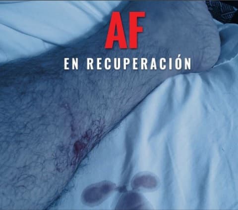 Un par de días después, el cantante desmintió que se hubiera tratado una mordida de jaguar, a pesar de que expertos aseguraron lo contrario. 'El Potrillo' dijo que Kush, su perro pastor inglés lo había mordido.