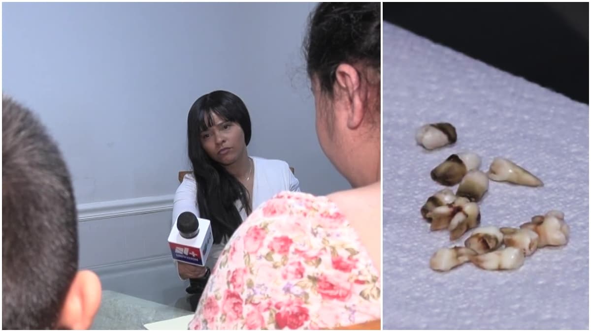 “Solo tenía los cuatro dientes de enfrente”: llevó a su hijo a clínica dental y salió con 11 dientes menos