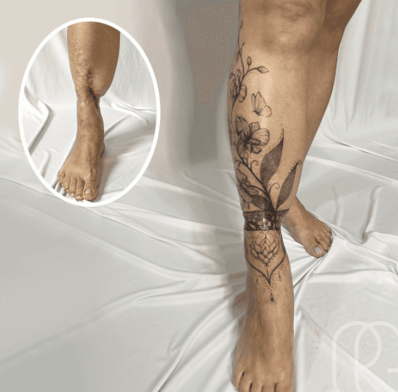 <b>Tatuando emociones</b>
<br>Esta imagen es de una señora de 49 años que fue atropellada a los 9, sufrió una gran fractura y por poco pierde su pierna.
<br>
<br>Por 40 años dejó de usar ropa corta, sin embargo, en diciembre de 2021 la tatuadora le hizo este diseño con el que logró cambiarle la vida por completo.