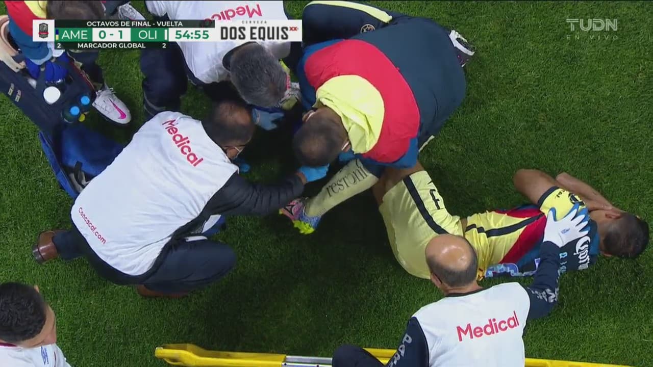 Chucho López sufre fractura de peroné por artera entrada