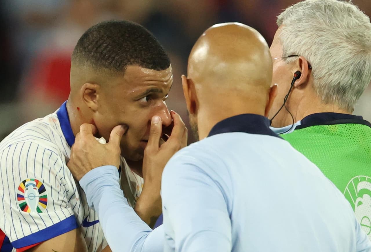 ¡Peligra la Euro! Mbappé sufre fractura y será operado