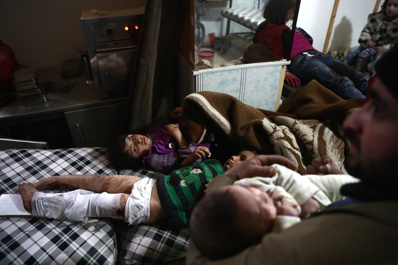 Varios niños heridos esperan en un hospital después del ataque aéreo sobre la ciudad rebelde de Douma, cerca de Damasco. 25 de febrero de 2017.