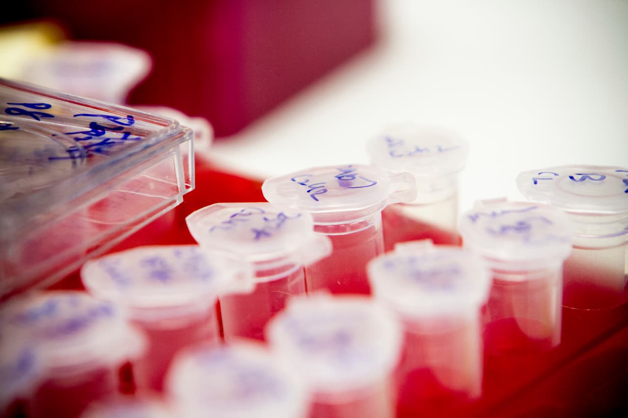 Resultados alentadores en desarrollo de una vacuna contra el VIH