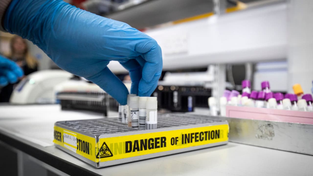 ¿Qué tan contagiosa es la nueva variante del coronavirus llamada ómicron? Un experto resuelve algunas dudas