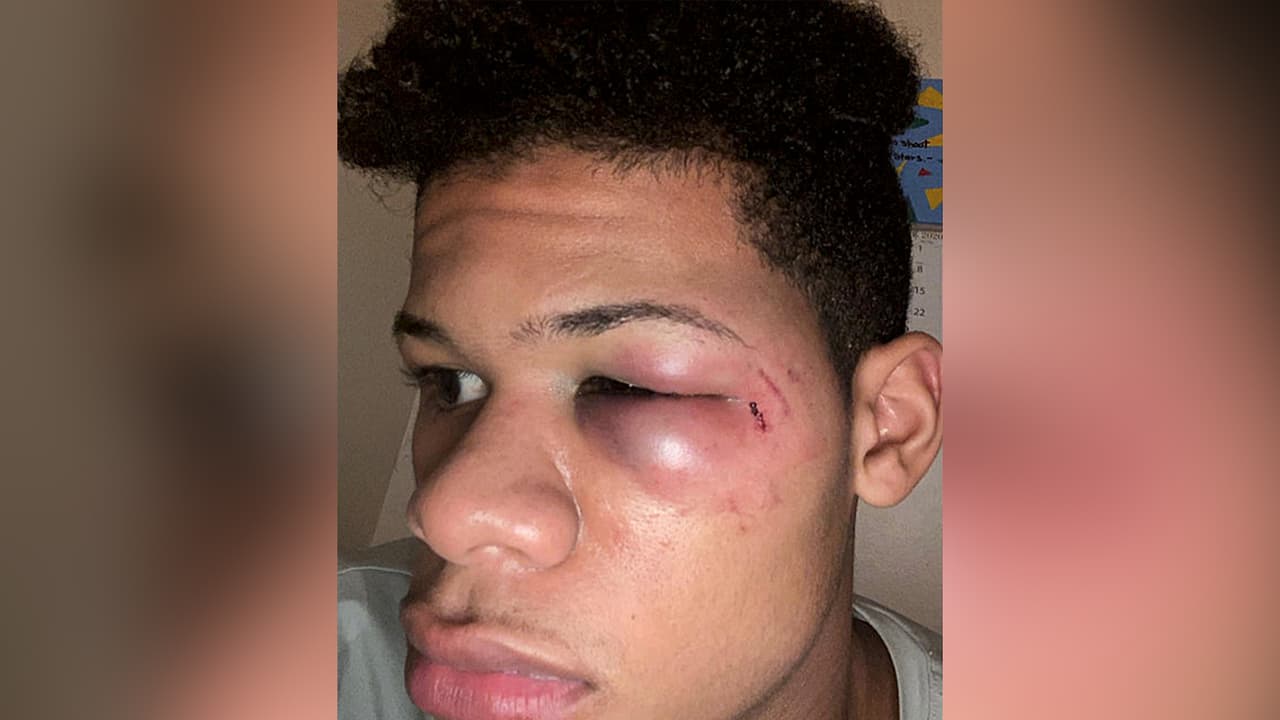 "Nunca pensé que me pasaría algo así": joven hispano denuncia que fue golpeado por un policía de Nueva Jersey