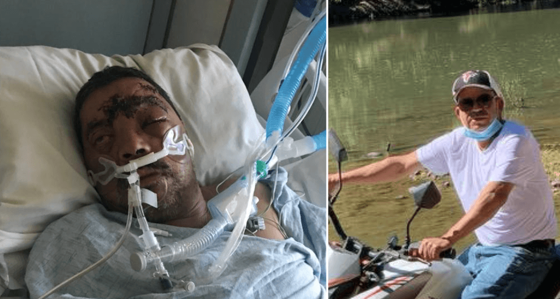 Mexicano lucha por su vida tras recibir una golpiza para robarle $600 en California