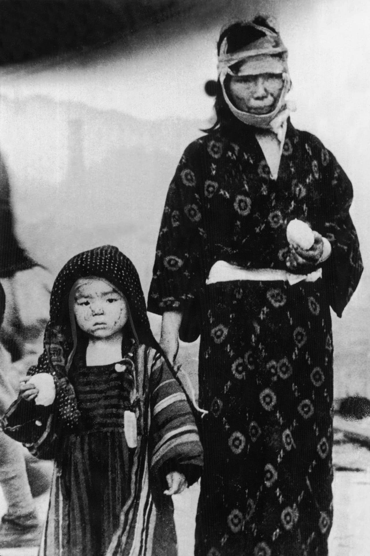 Una mujer y un niño en ropa tradicional japonesa, sobrevivientes a la bomba atómica caída en Nagasaki. Sus caras están marcadas con quemaduras por el calor de la explosión.