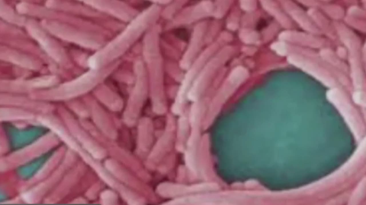 Alertan sobre dos casos de legionella en un complejo de viviendas públicas de El Bronx
